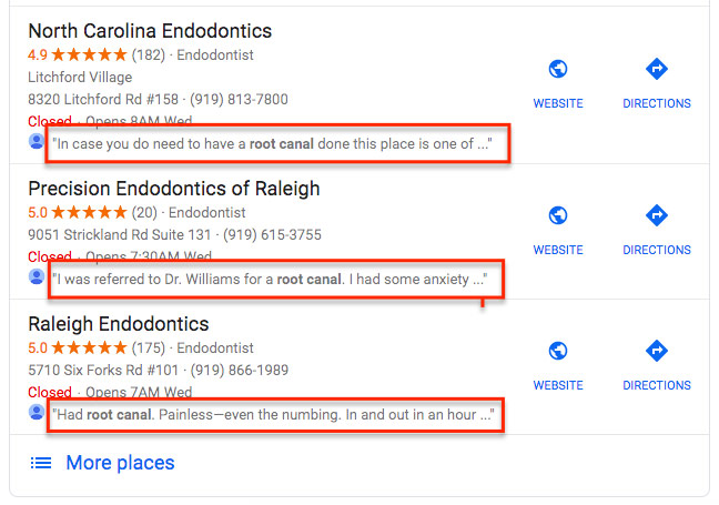 price of veneers in India Adventures